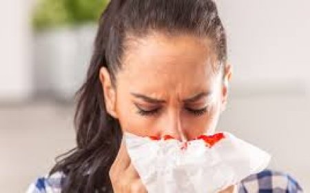 خطوات الوقاية من نزيف الأنف أثناء ارتفاع درجات الحرارة