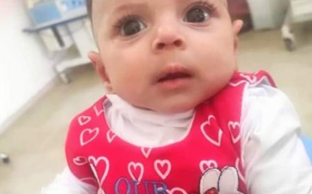 مستشفي دسوق العام بكفرالشيخ ينقذ حياة رضيعة من خطر نزيف بالمخ 